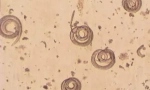 Що таке trichinella spiralis