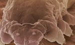 Mite demodex та особливості його засобів до існування