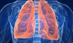 Розробка паразитів у легенях людини: симптоми та діагностика