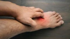 Алергія для укусу цвітіння в людині