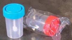 Аналіз яєць на яйці