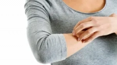 Ніж небезпечні блохи для людини?