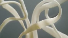 Наскільки небезпечні стрічки черв'яків у людей і їх симптоми