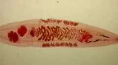 Що таке опрісторія