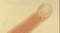 Що таке анкілост?