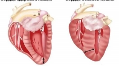 Що гіпертрофічна кардіоміопатія в кішках і що це небезпечно