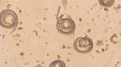 Що таке trichinella spiralis