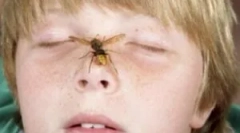 Дії батьків, якщо дитина біт оси