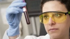 Як аналіз крові здійснюється на токсоплазмозі