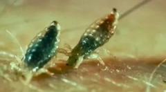 Які укуси воші виглядають?