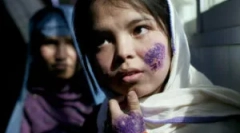 Як інфікувати лейшмені: симптоми та лікування лейшманіозу