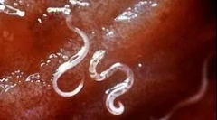 Як живе малярія плазмодію і розвивається