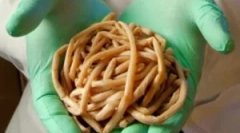 Які черв'яки живуть у людському тілі