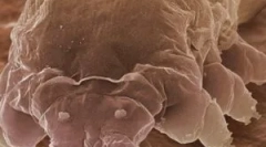 Mite demodex та особливості його засобів до існування