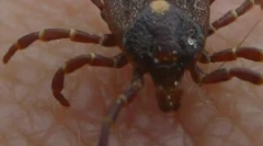 Магнітний моноцитарський ерліхооз