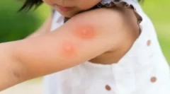 Найпопулярніші інструменти з комарів для дітей