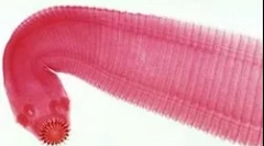 Найпоширеніші типи черв'яків у людей