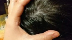 Народні домашні засоби від вошей та об'яви