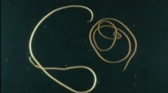 Це небезпечне паразитське волосся