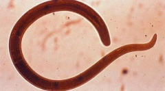 Небезпечні черв'яки