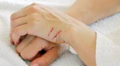 Чому котячі борються