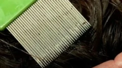 Процедура завершення для вошей та nd