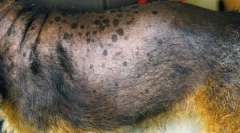 Розлади надниркових залоз