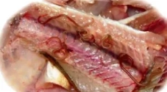 Симптоми та лікування опісторхозу