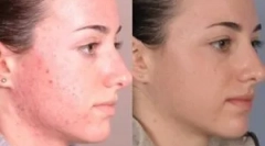 Засоби для лікування демодикозу