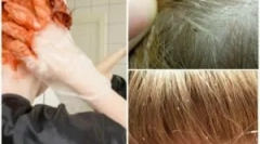 Чи вбиває вошей волосся?