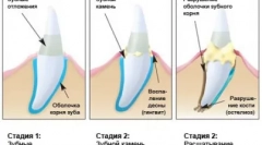 Домашній догляд predator - очищення cattick
