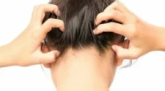 Типи паразитарних комах у чоловічій голові