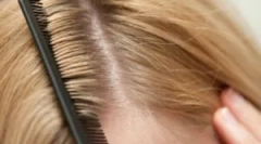 Сорти вошей у людей