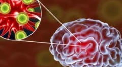 Вірусний енцефаліт мозку: види та симптоми