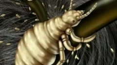 Воші та їх інкубаційний період