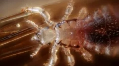 Воші, такі як носії хвороби