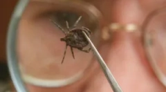 Людина інфекція з кліщовим енцефалітом